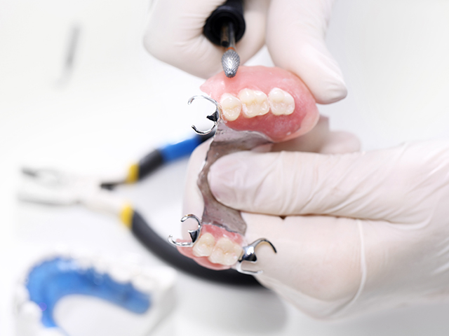 歯科技工所の連携による各種入れ歯への対応